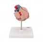 Coeur classique avec  HVG, en 2 parties 