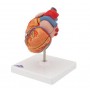 Coeur classique avec  HVG, en 2 parties 