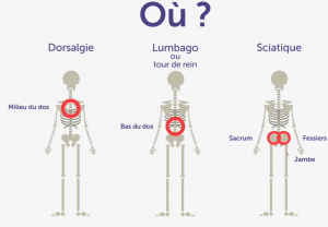 douleurs du dos