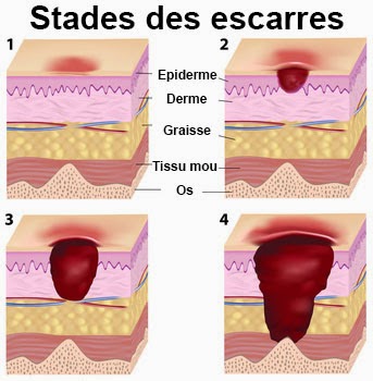 Pourquoi utiliser le drap d'examen ? - BLOG TOOMED