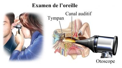 Otorhinolaryngologiste Utilise L'otoscope Pour Examiner Les