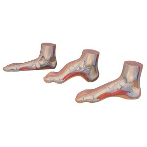série de pieds mini