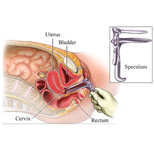 spéculum
