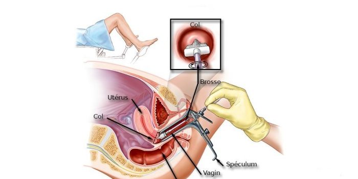 spéculum vaginal