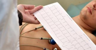 L'électrocardiogramme  ou ECG