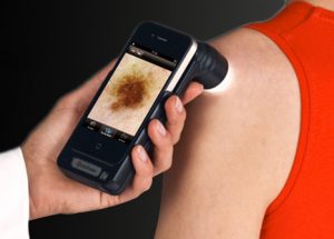 dermoscope
