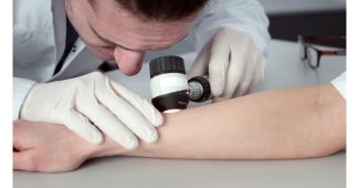 dermatoscopes
