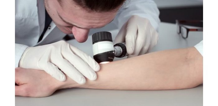 dermatoscopes