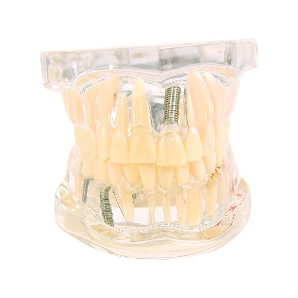 https://www.toomed.com/dentaire/4617-mod%C3%A8le-transparent-de-la-m%C3%A2choire-avec-dents-adultes.html