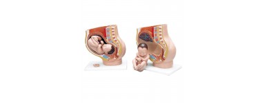 Représentation des stades de grossesse, evolution du foetus prix réduit